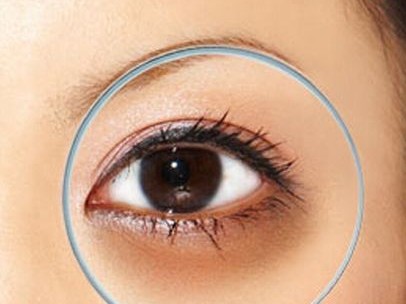 黑眼圈重到像熊猫揭秘背后原因与应对妙招